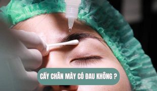 Cấy chân mày có đau không? Những điều bạn cần biết trước khi quyết định