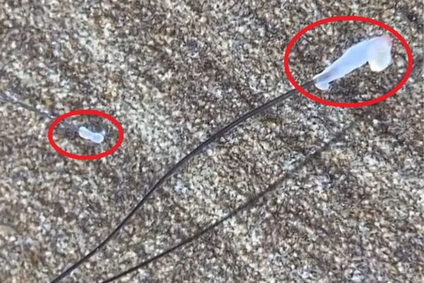 Tóc rụng có hạt trắng ở chân tóc: Nguyên nhân, dấu hiệu và cách khắc phục hiệu quả