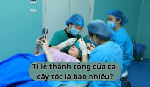 Tỷ lệ thành công của ca cấy tóc là bao nhiêu? Những yếu tố quyết định cần biết