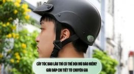 Cấy tóc bao lâu thì có thể đội mũ bảo hiểm? Giải đáp chi tiết từ chuyên gia