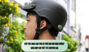 Cấy tóc bao lâu thì có thể đội mũ bảo hiểm? Giải đáp chi tiết từ chuyên gia