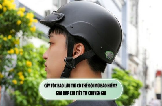 Cấy tóc bao lâu thì có thể đội mũ bảo hiểm? Giải đáp chi tiết từ chuyên gia