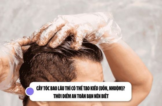 Cấy tóc bao lâu thì có thể tạo kiểu (uốn, nhuộm)? Thời điểm an toàn bạn nên biết