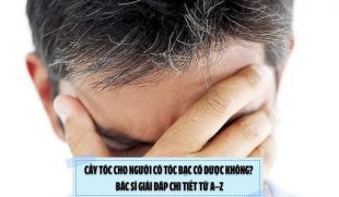 Cấy tóc cho người có tóc bạc có được không? Bác sĩ giải đáp chi tiết từ A–Z