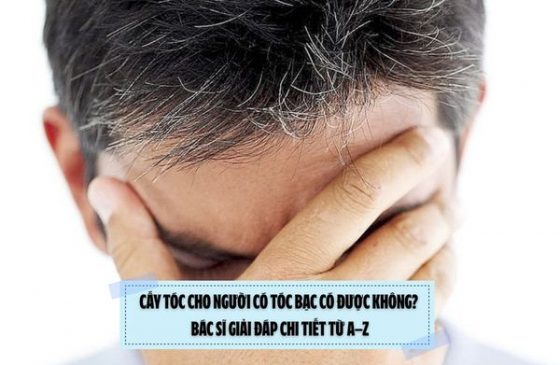 Cấy tóc cho người có tóc bạc có được không? Bác sĩ giải đáp chi tiết từ A–Z