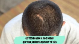 Cấy tóc cho vùng bị sẹo ở da đầu: Quy trình, chi phí và địa chỉ uy tín 2026
