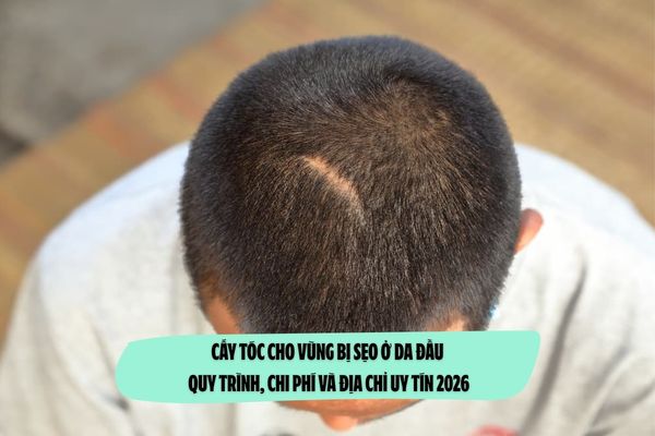 Cấy tóc cho vùng bị sẹo ở da đầu: Quy trình, chi phí và địa chỉ uy tín 2026