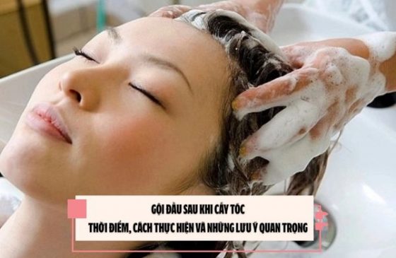 Gội đầu sau khi cấy tóc: Thời điểm, cách thực hiện và những lưu ý quan trọng 