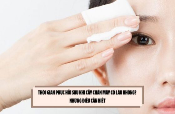 Thời gian phục hồi sau khi cấy chân mày có lâu không? Những điều cần biết