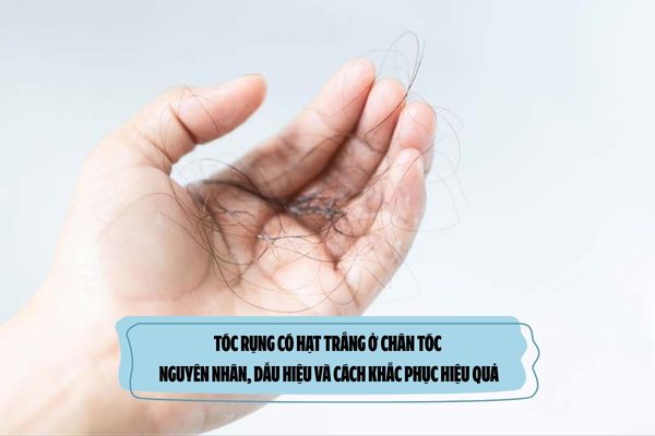 Tóc rụng có hạt trắng ở chân tóc: Nguyên nhân, dấu hiệu và cách khắc phục hiệu quả