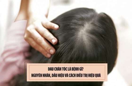 Đau chân tóc là bệnh gì? Nguyên nhân, dấu hiệu và cách điều trị hiệu quả