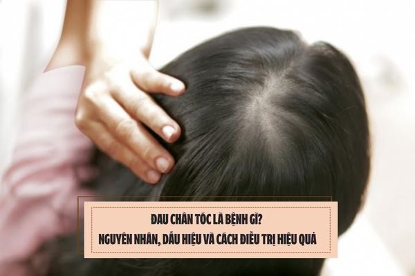 Đau chân tóc là bệnh gì? Nguyên nhân, dấu hiệu và cách điều trị hiệu quả