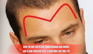 Điều trị hói chữ M giá thành khoảng bao nhiêu? Bác sĩ giải thích rõ từ A–Z (kèm mức giá thực tế)