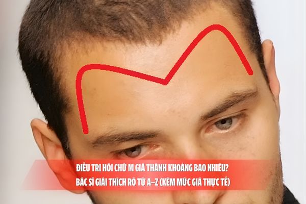 Điều trị hói chữ M giá thành khoảng bao nhiêu? Bác sĩ giải thích rõ từ A–Z (kèm mức giá thực tế)