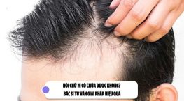 Hói chữ M có chữa được không? Bác sĩ tư vấn giải pháp hiệu quả
