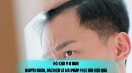 Hói chữ M ở nam: Nguyên nhân, dấu hiệu và giải pháp phục hồi hiệu quả
