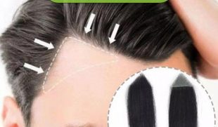 Miếng dán hói chữ M có hiệu quả không? Sự thật bạn cần biết trước khi quyết định