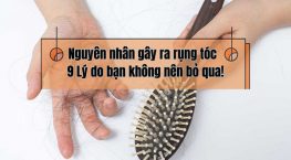 [Bóc mẽ] Nguyên nhân gây ra rụng tóc – 9 Lý do bạn không nên bỏ qua!