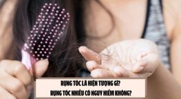 Rụng tóc là hiện tượng gì? Rụng tóc nhiều có nguy hiểm không?