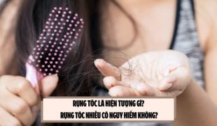 Rụng tóc là hiện tượng gì? Rụng tóc nhiều có nguy hiểm không?