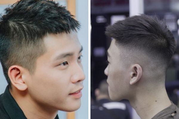 Kiểu tóc trán hói chữ M: Gợi ý giúp che khuyết điểm và cải thiện diện mạo