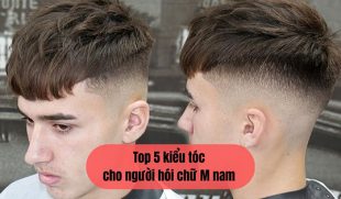 Top 5 kiểu tóc cho người hói chữ M nam giúp che khuyết điểm hiệu quả & lấy lại sự tự tin