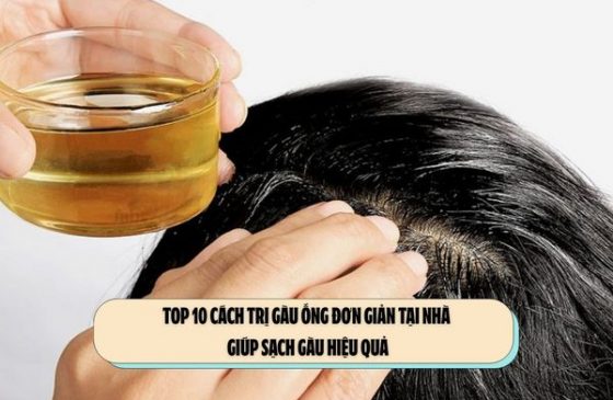 TOP 10 Cách trị gàu ống đơn giản tại nhà giúp sạch gàu hiệu quả