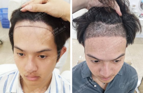 Nguyễn Hoàng Hưng