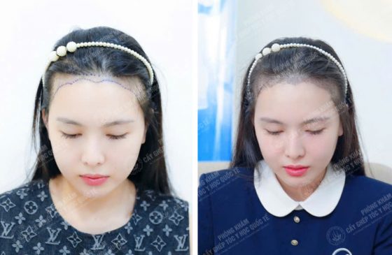 Đào Thị Phương