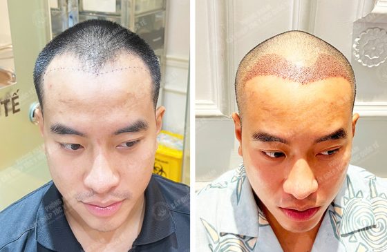 Nguyễn Nhật Hoàng