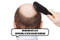 Hói đầu hình chữ O là gì? Nguyên nhân, cơ chế và cách điều trị hiệu quả