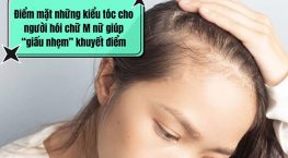 Điểm mặt những kiểu tóc cho người hói chữ M nữ giúp “giấu nhẹm” khuyết điểm
