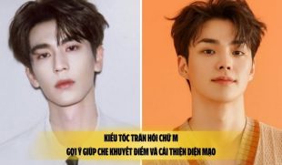 Kiểu tóc trán hói chữ M: Gợi ý giúp che khuyết điểm và cải thiện diện mạo