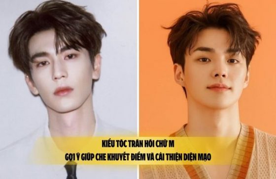 Kiểu tóc trán hói chữ M: Gợi ý giúp che khuyết điểm và cải thiện diện mạo