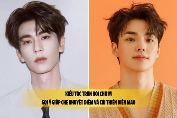 Kiểu tóc trán hói chữ M: Gợi ý giúp che khuyết điểm và cải thiện diện mạo