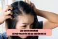 Cách chữa hói đỉnh đầu nữ: Giải pháp phục hồi tóc hiệu quả theo từng mức độ