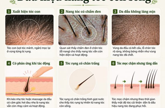 Dấu hiệu nang tóc còn sống: 6 cách nhận biết chính xác