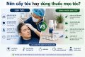 Nên cấy tóc hay dùng thuốc mọc tóc