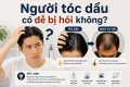 Người tóc dầu có dễ bị hói không