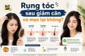 Rụng tóc sau giảm cân có mọc lại không?