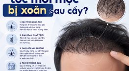 Vì sao tóc mới mọc bị xoăn sau cấy? Giải đáp từ chuyên gia