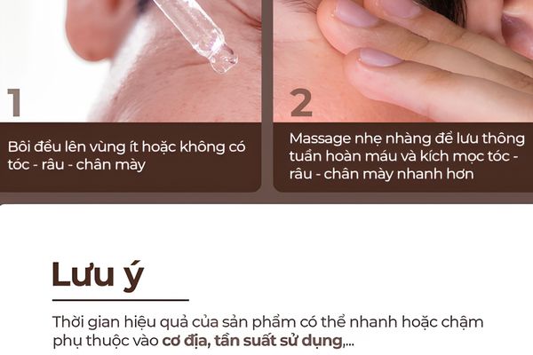 Có nên dùng thuốc mọc râu Abera không? Đánh giá ưu - nhược điểm thực tế
