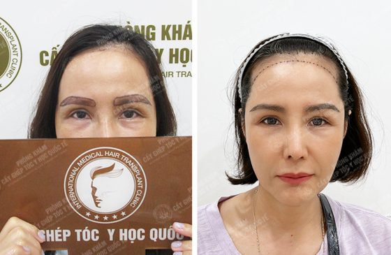 Nguyễn Lệ Quyên