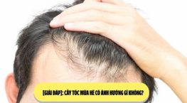 [Giải đáp]: Cấy tóc mùa hè có ảnh hưởng gì không? 