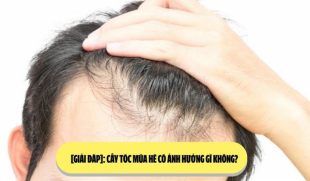 [Giải đáp]: Cấy tóc mùa hè có ảnh hưởng gì không? 