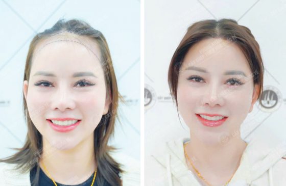 Lê Bảo Hân