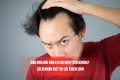 Đàn ông hói đầu có già hơn tuổi không? Cách nhận biết và cải thiện sớm