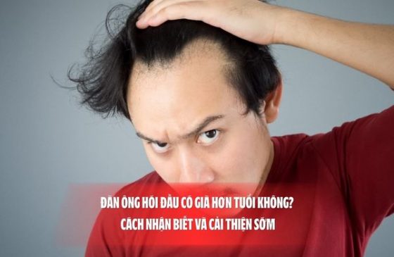 Đàn ông hói đầu có già hơn tuổi không? Cách nhận biết và cải thiện sớm