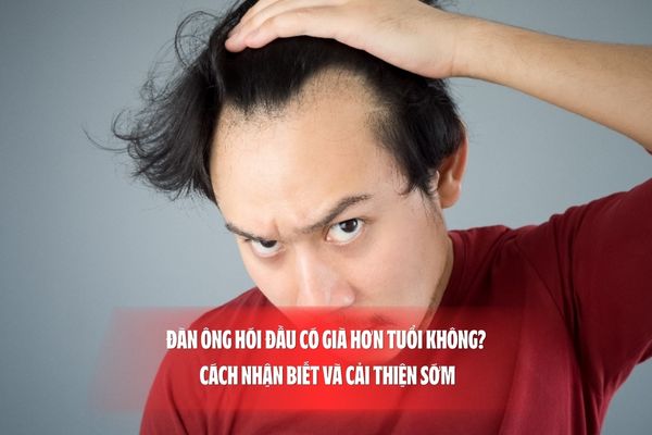 Đàn ông hói đầu có già hơn tuổi không? Cách nhận biết và cải thiện sớm
