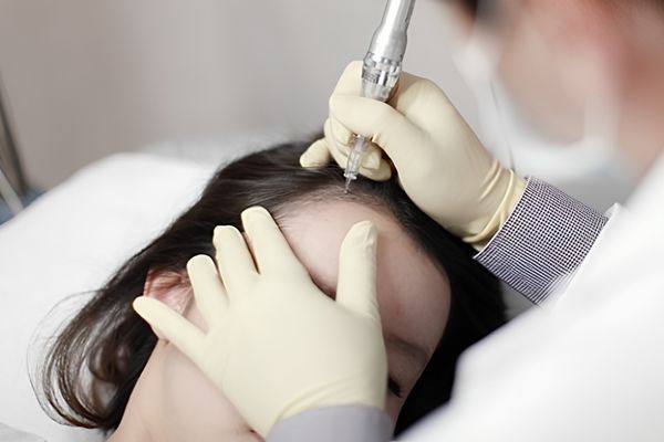 Các phương pháp định hình đường chân tóc giúp cải thiện tóc chữ M và trán cao 